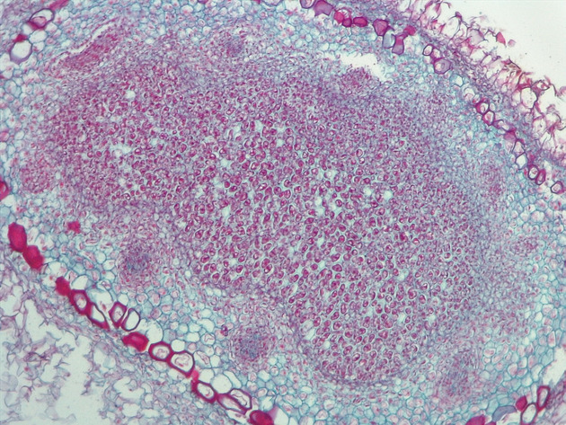 Root Nodule Slides - Root Nodule 01 100X